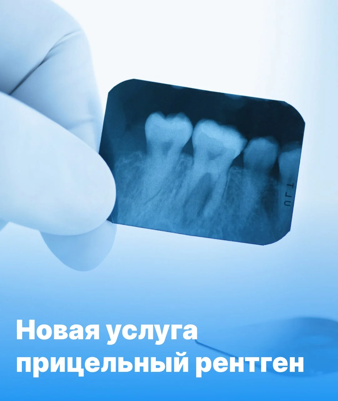 Прицельный стоматологический рентген донецк, макеевка